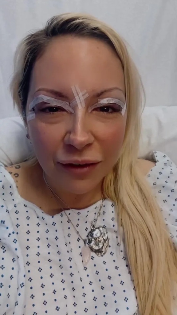 Jodie Marsh after cosmetic surgery
