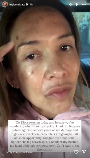 Myleene Klass Instagram Story