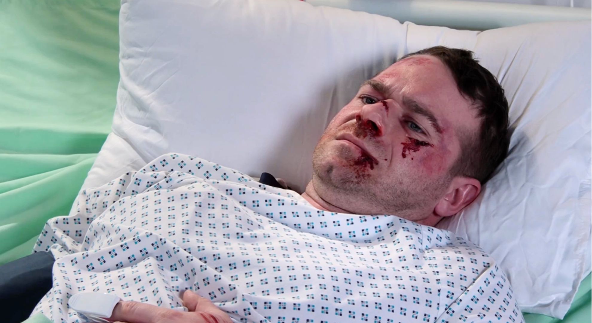 Coronation Street's Mick beaten up in the hospital bed