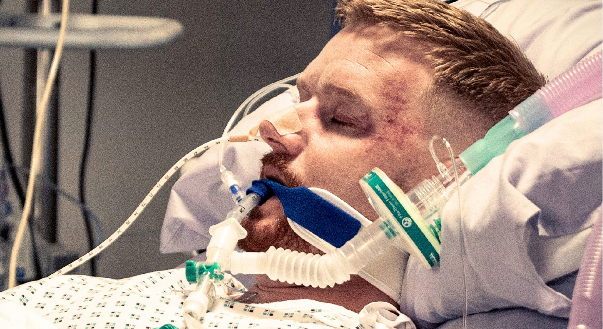 Coronation Street's Gary in a coma