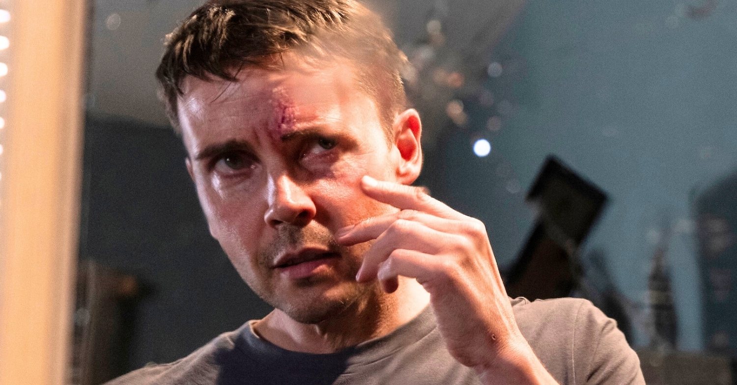 Coronation Street's Todd with cut on face