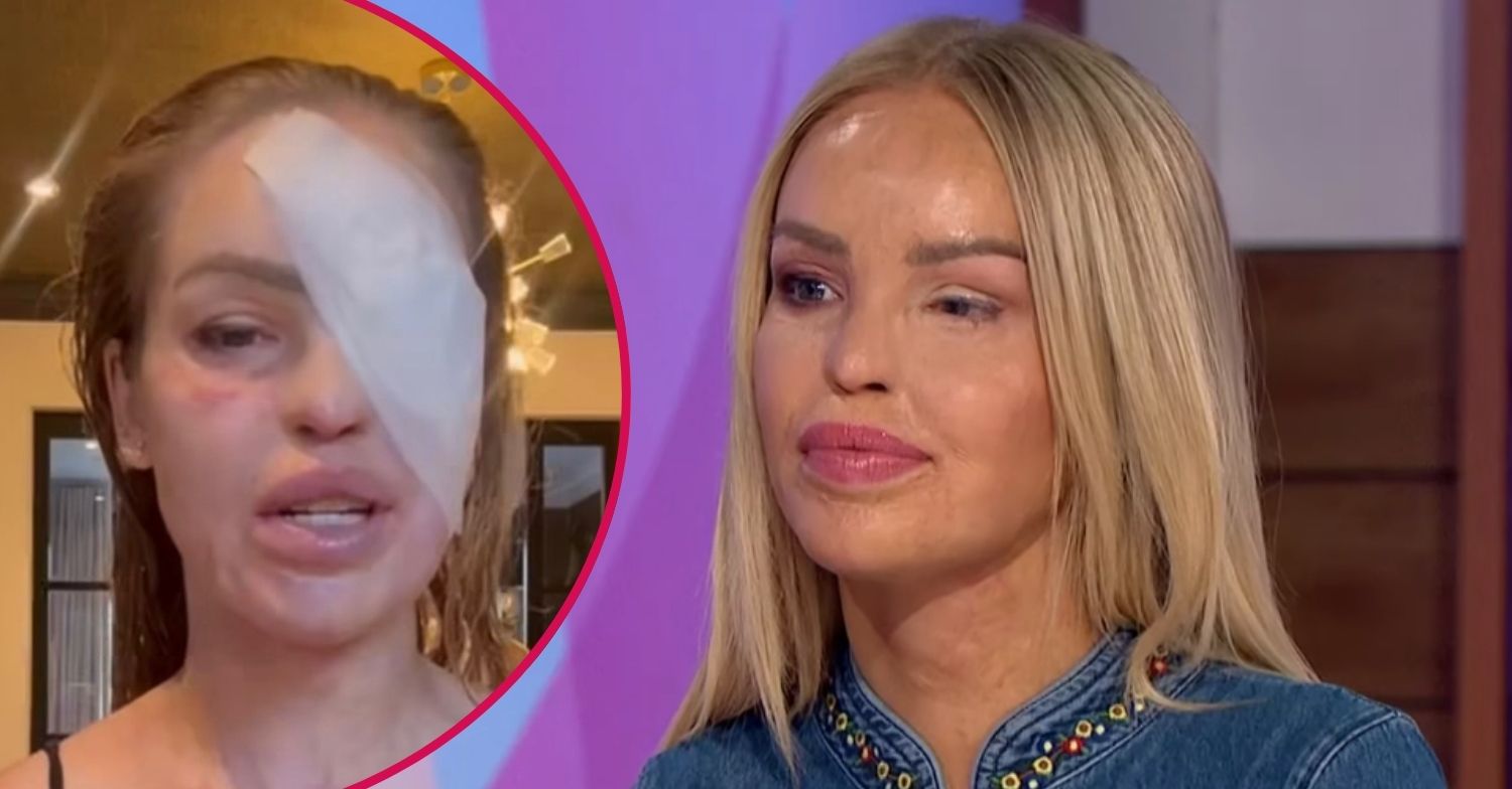 Katie piper with bandage on her face