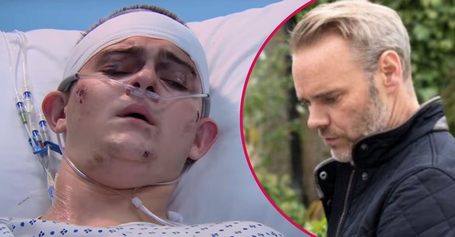 ED split pic: Dylan in hospital / Ray annoyed in Emmerdale