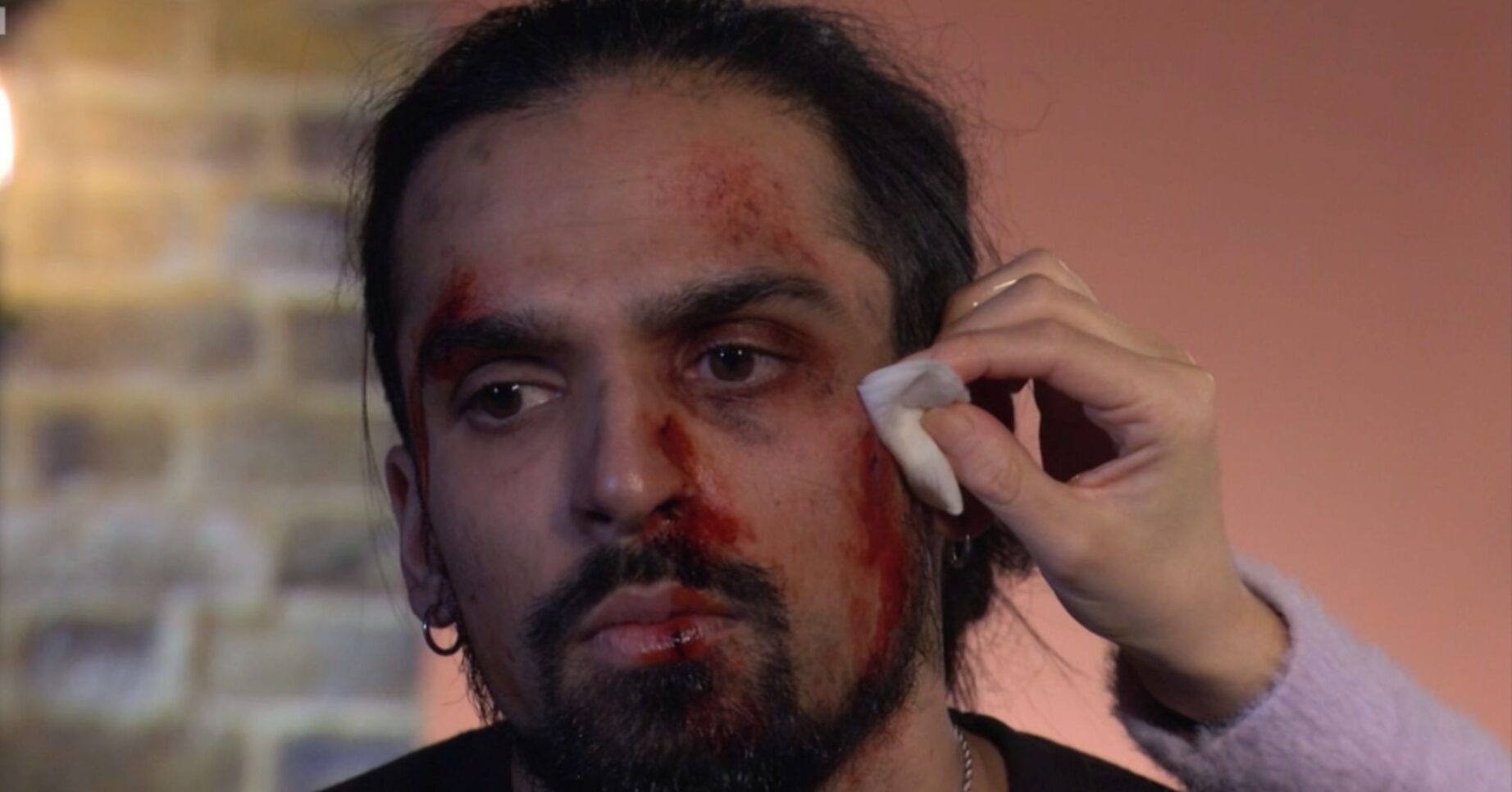 EastEnders Ravi with cuts all over his face