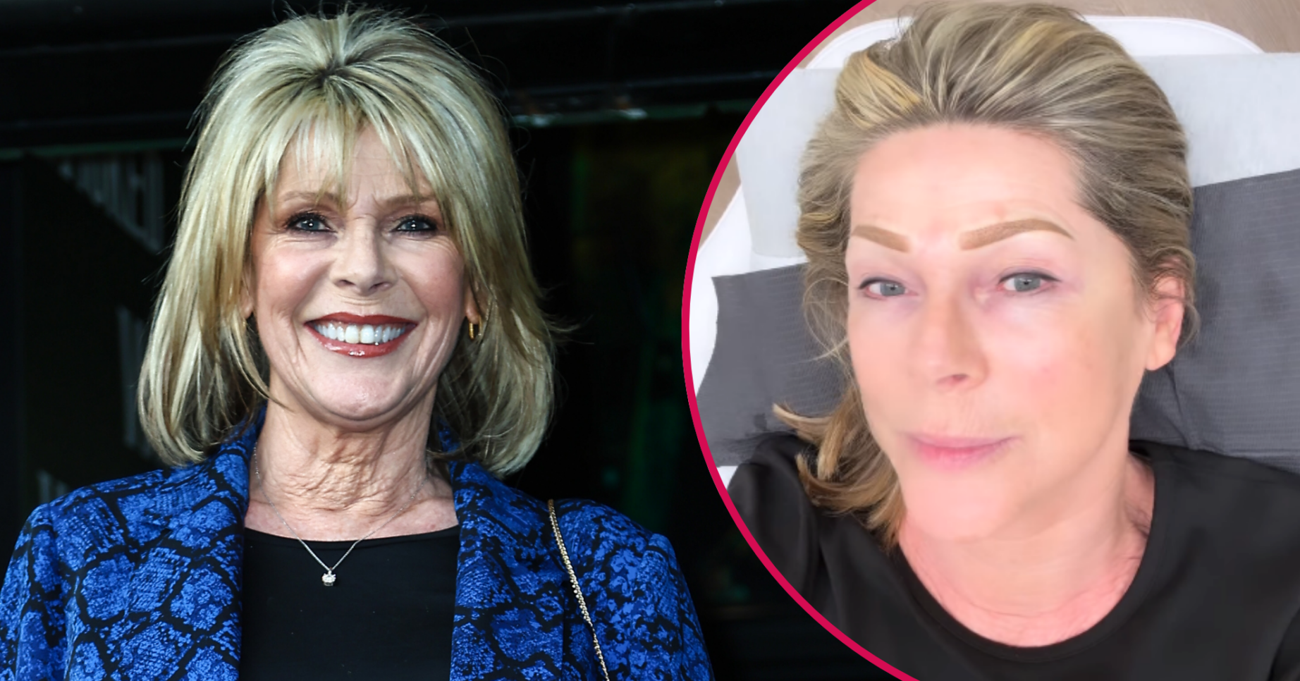 Ruth Langsford smiling and having her tattoo done