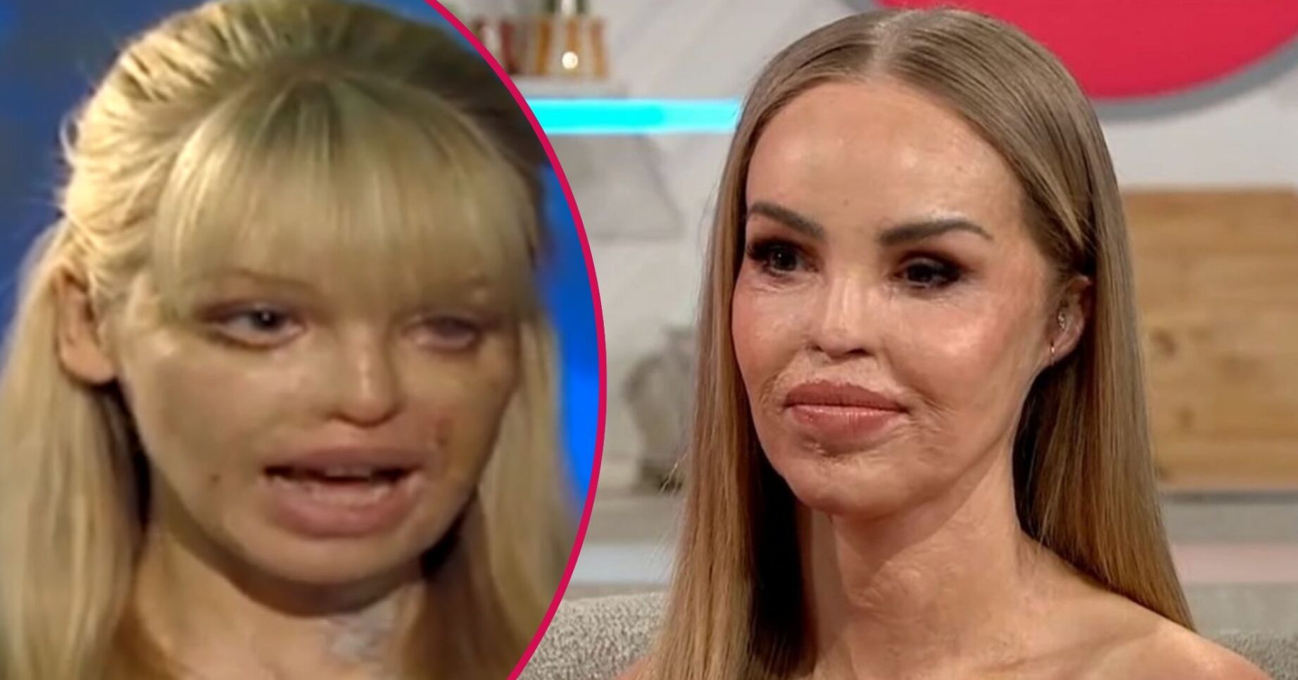Katie Piper talking