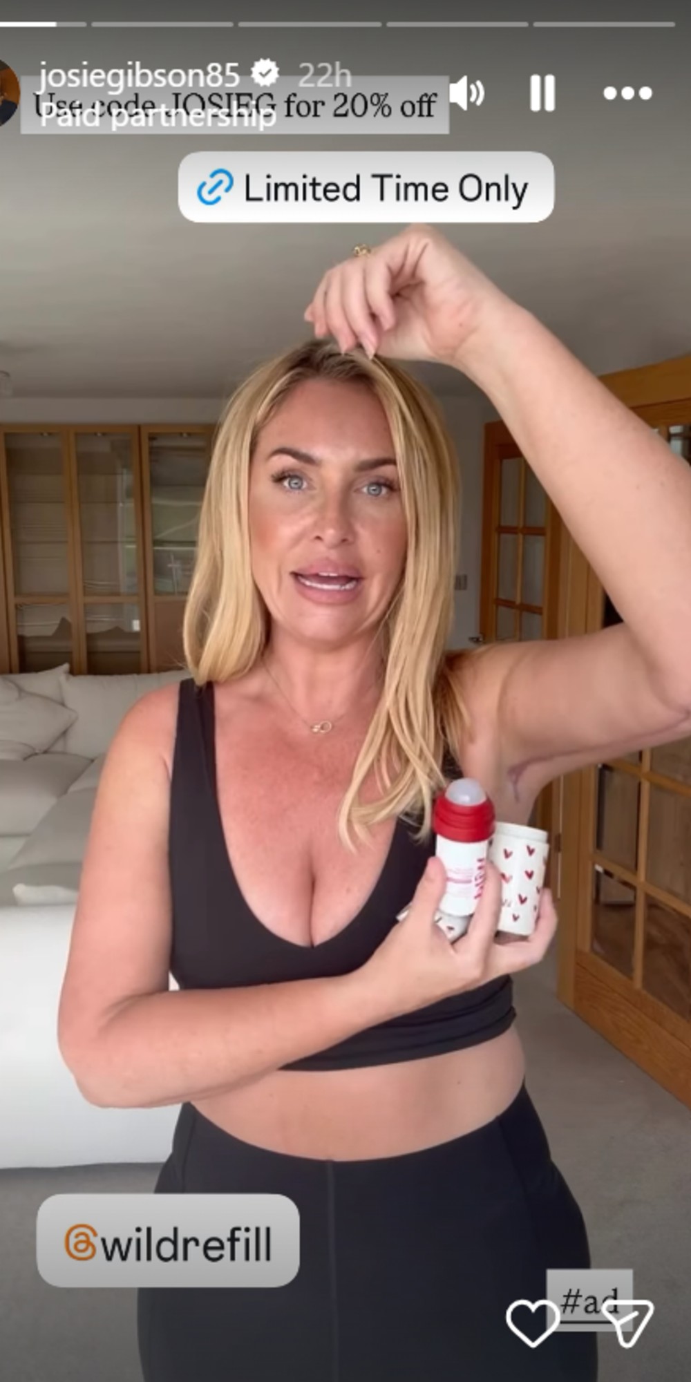 Josie Gibson revealing arm scars on Instagram