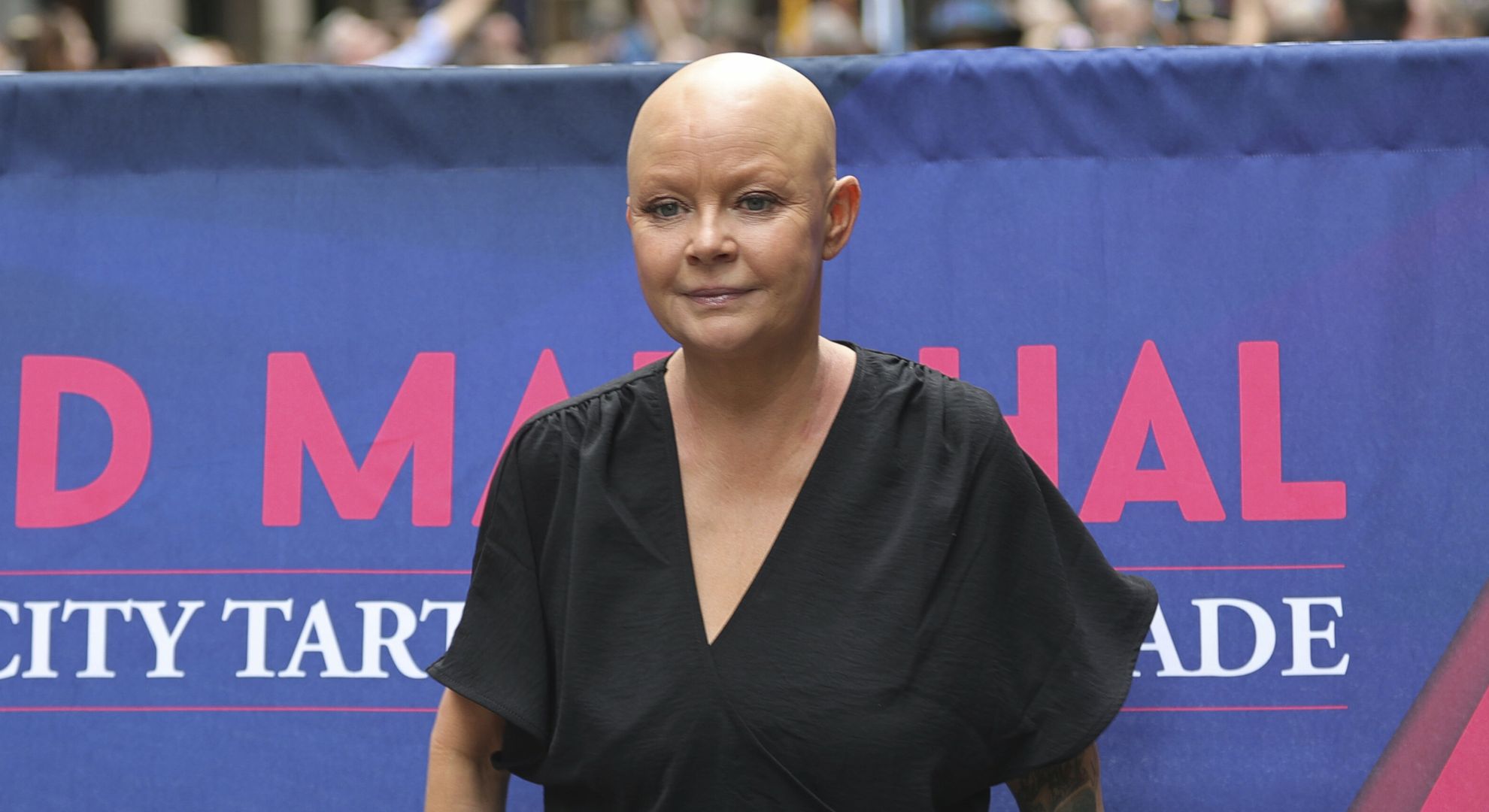 ‘Scarred’ Gail Porter reveals facial injuries after tube accident
