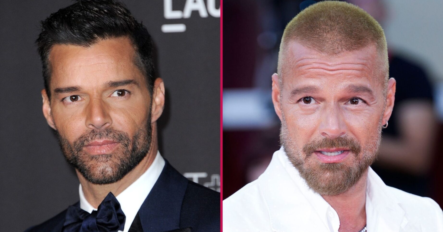 Ricky Martin before and after