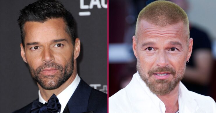 Ricky Martin before and after