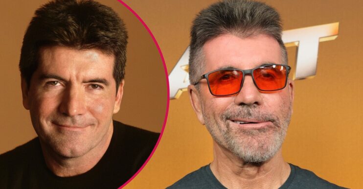 Simon Cowell before and after