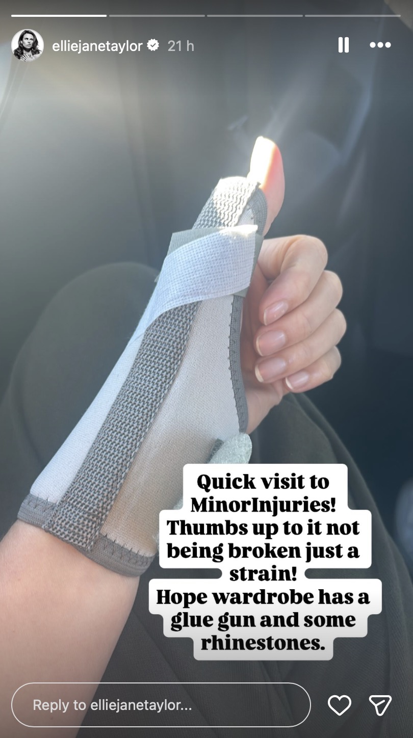 Ellie Taylor's injured thumb 
