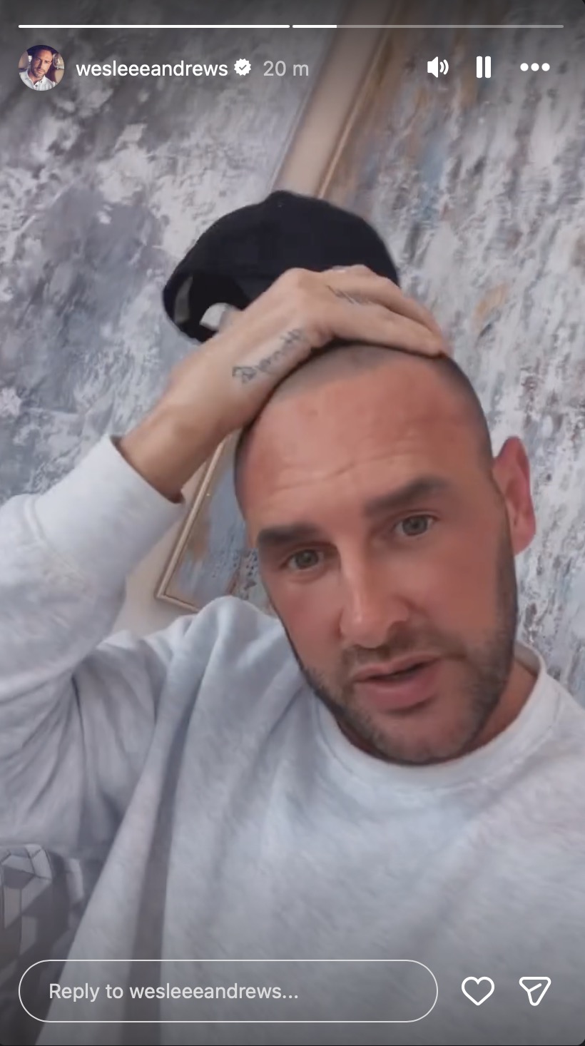 Lee Andrews showing off shaved head 